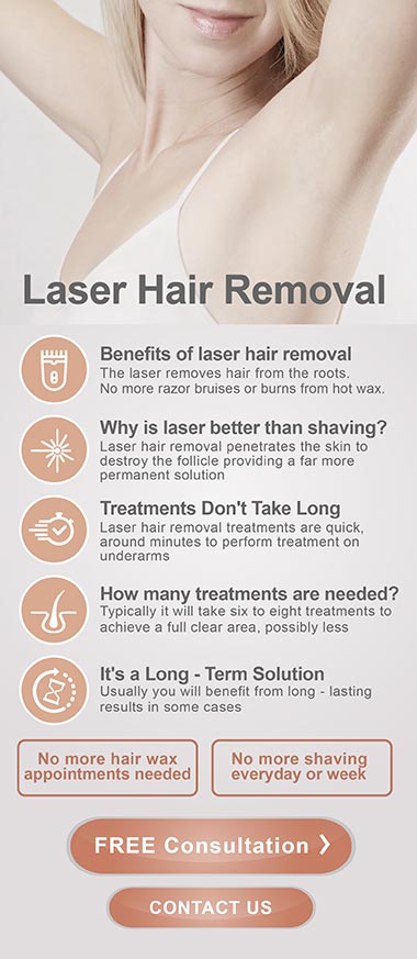 laser hair removal london